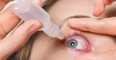 Ojo seco