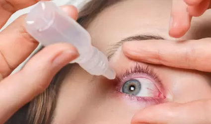 Ojo seco