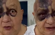 Luis de Alba reaparece con el rostro con moretones tras fuerte accidente