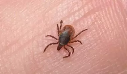 Rickettsiosis