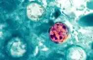 El monitoreo del condado no muestra brotes locales de ciclosporiasis; se recomienda tomar medidas de seguridad alimentaria