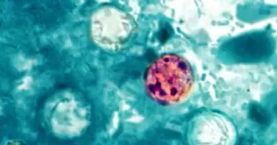ciclosporiasis