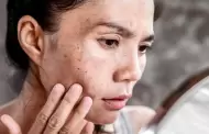 Protocolo: �C�mo tratar manchas en piel sensible sin empeorar la irritaci�n?